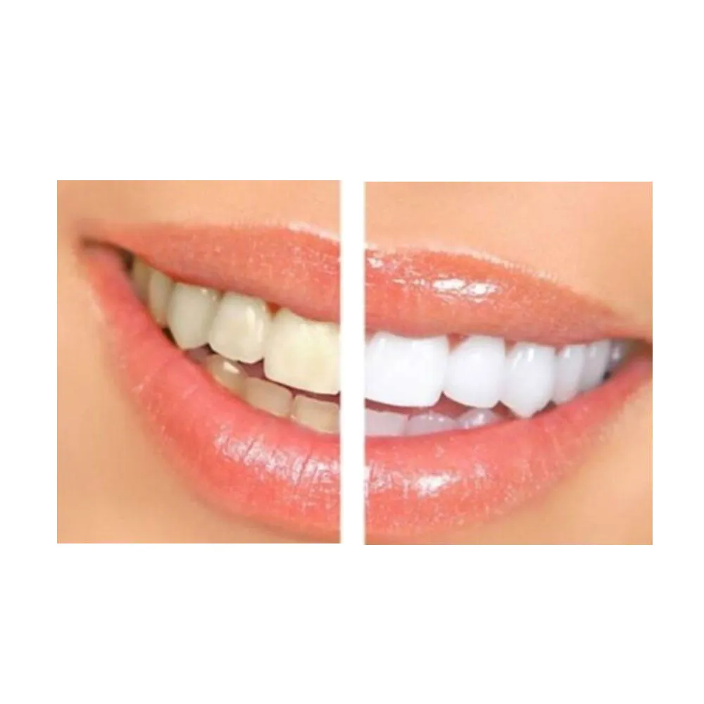 2 Packs White Professional Strength Instant Teeth Whitening Pens Clean Bleaching