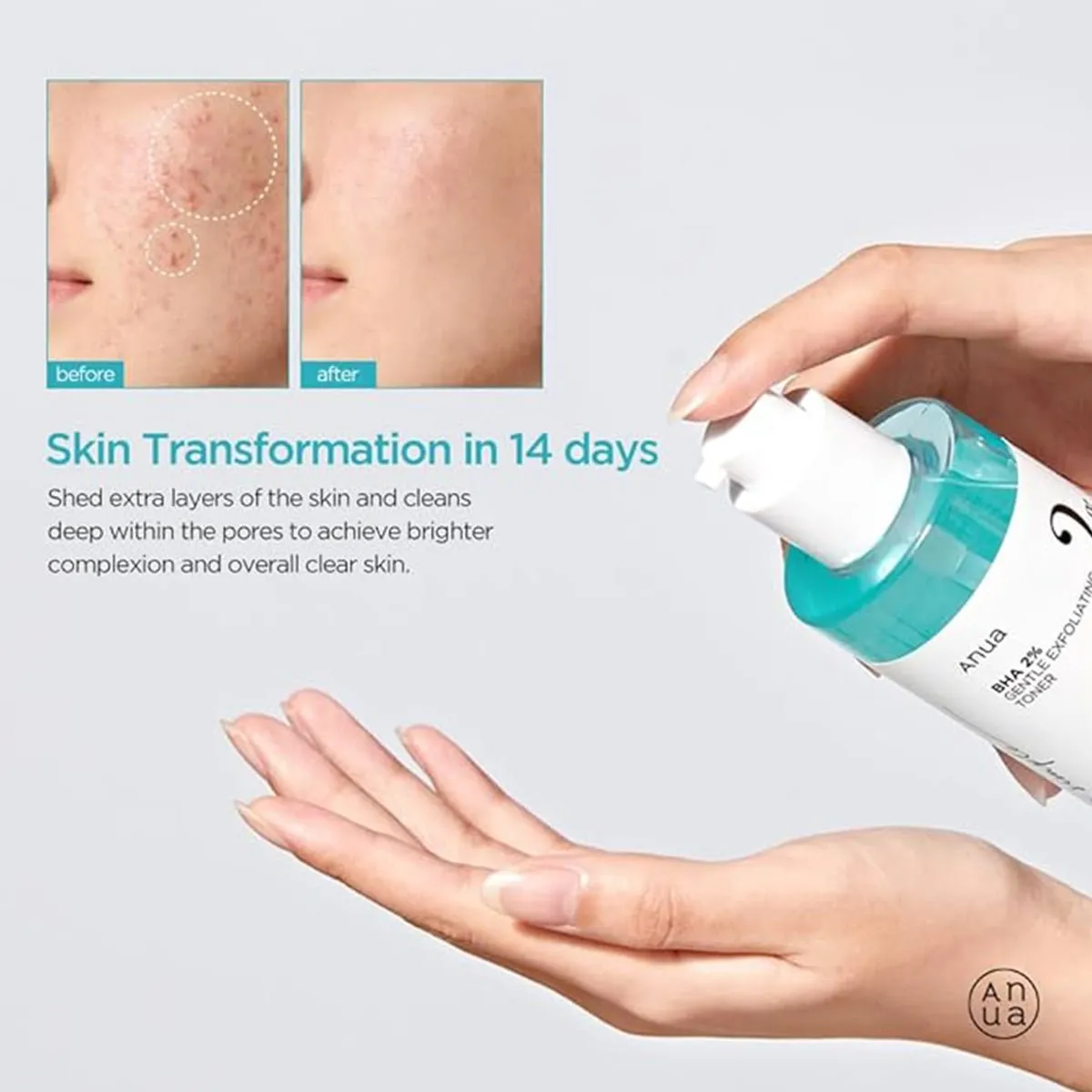 Anua Gentle Toner 150ML