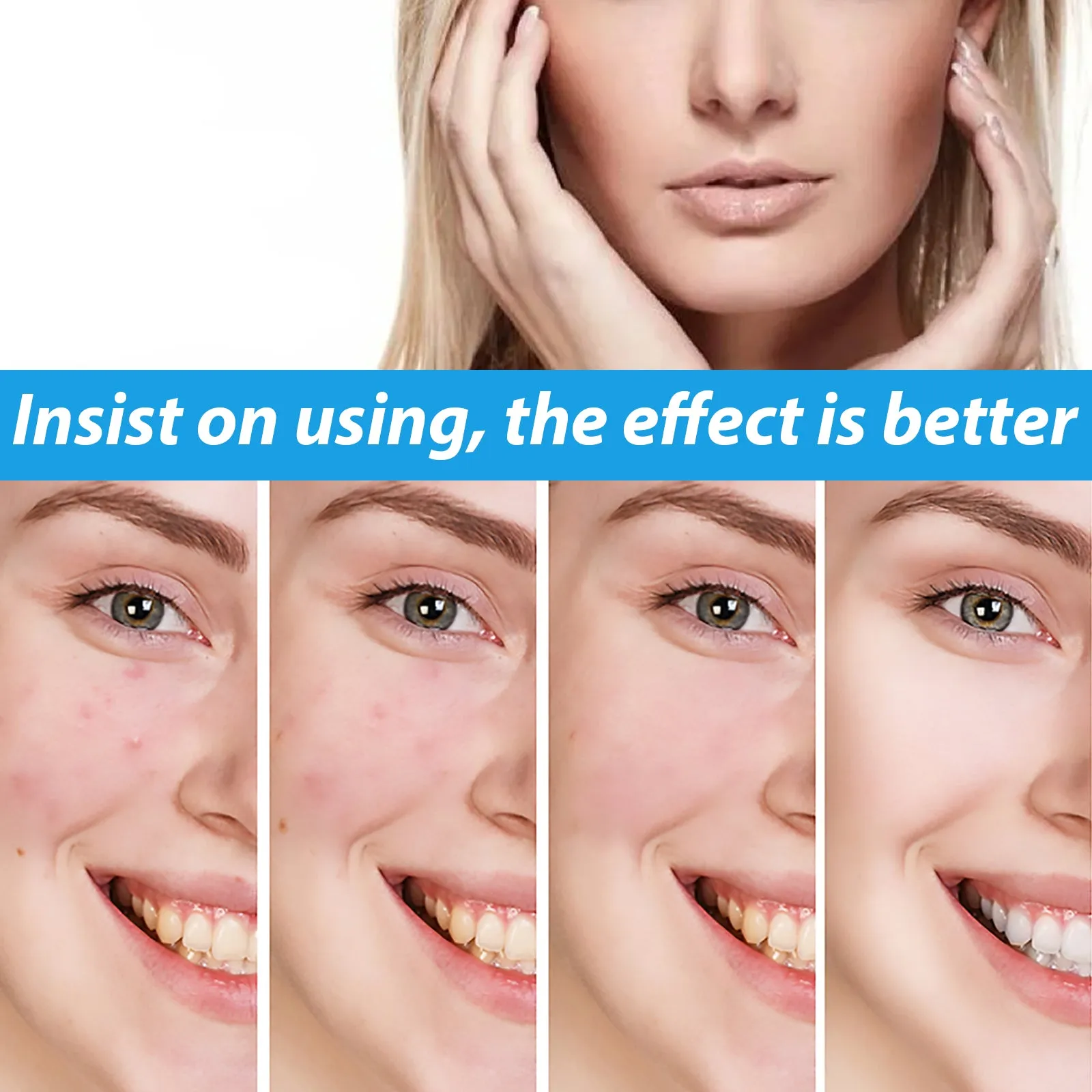 EELHOE™ Dark Spot and Acne Treatment Lotion