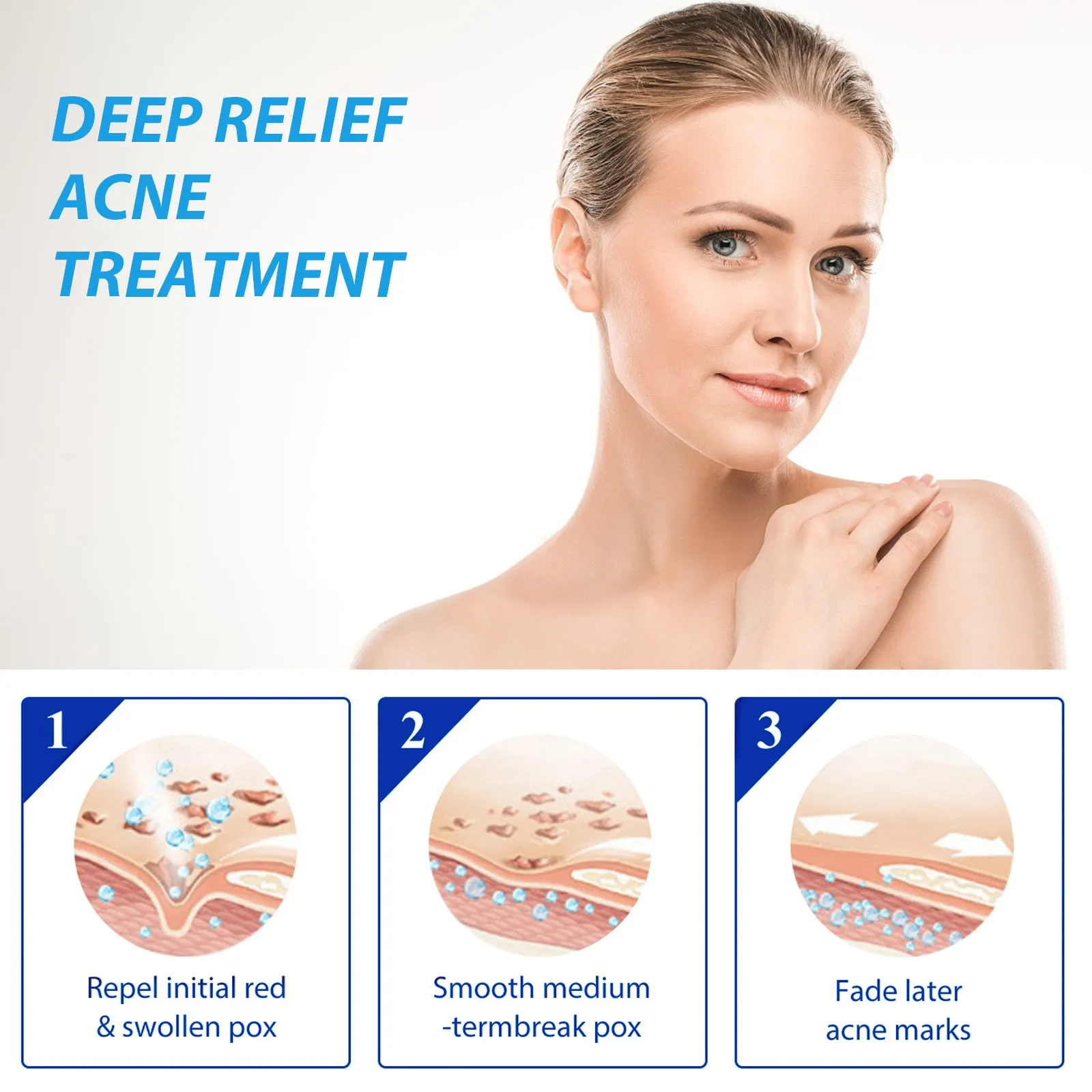 EELHOE™ Dark Spot and Acne Treatment Lotion