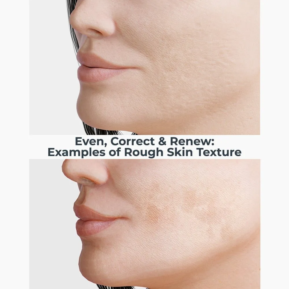 Even, Correct and Firm Duo