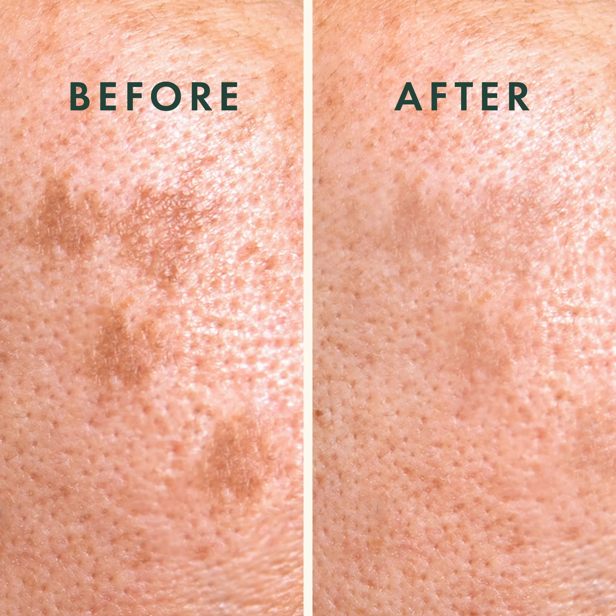Microcrystal Dark Spot Cover