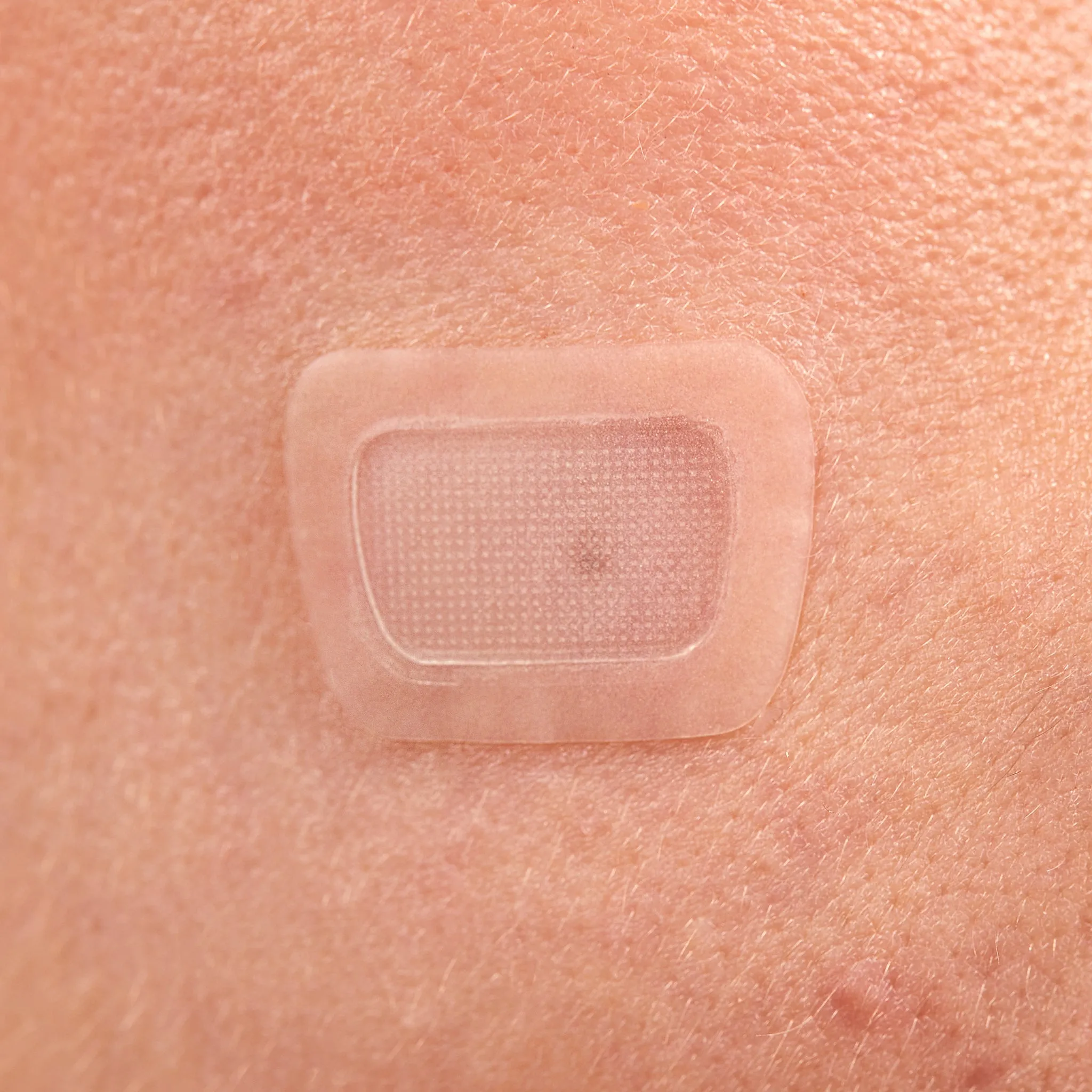 Microcrystal Dark Spot Cover